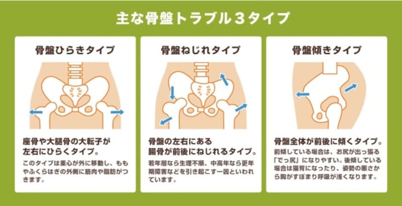 ゆがみ
